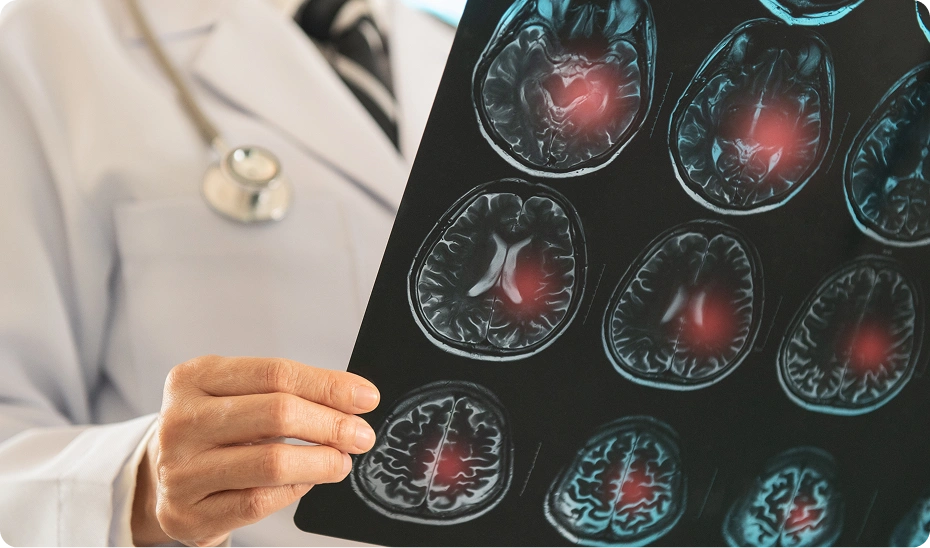 Doctor examining brain scan images.